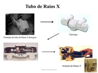 Tubo de Raios X
Proteção do tubo de Raios X (Sangue)
Carcaça
Ampola de Raios X
Antonio Carlos Moreira
 