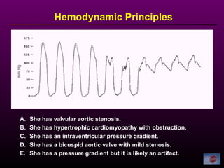Hemodynamic Principles
A. She has valvular aortic stenosis.
B. She has hypertrophic cardiomyopathy with obstruction.
C. She has an intraventricular pressure gradient.
D. She has a bicuspid aortic valve with mild stenosis.
E. She has a pressure gradient but it is likely an artifact.
 