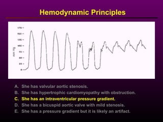 Hemodynamic Principles
A. She has valvular aortic stenosis.
B. She has hypertrophic cardiomyopathy with obstruction.
C. She has an intraventricular pressure gradient.
D. She has a bicuspid aortic valve with mild stenosis.
E. She has a pressure gradient but it is likely an artifact.
 