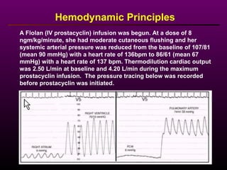 A Flolan (IV prostacyclin) infusion was begun. At a dose of 8
ngm/kg/minute, she had moderate cutaneous flushing and her
systemic arterial pressure was reduced from the baseline of 107/81
(mean 90 mmHg) with a heart rate of 136bpm to 86/61 (mean 67
mmHg) with a heart rate of 137 bpm. Thermodilution cardiac output
was 2.50 L/min at baseline and 4.20 L/min during the maximum
prostacyclin infusion. The pressure tracing below was recorded
before prostacyclin was initiated.
Hemodynamic Principles
 