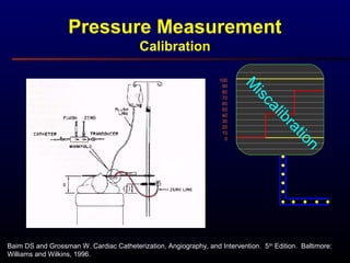 Baim DS and Grossman W. Cardiac Catheterization, Angiography, and Intervention. 5th
Edition. Baltimore:
Williams and Wilkins, 1996.
Pressure Measurement
Calibration
100
90
80
70
60
50
40
30
20
10
0
M
iscalibration
 