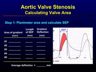 Aortic Valve Stenosis
Calculating Valve Area
SEP
Step 1: Planimeter area and calculate SEP
Gradient
Deflection
Length
of SEPArea of gradient
(mm2
) (mm) (mm)
#1
#2
#3
#4
#5
Average deflection = mm
 