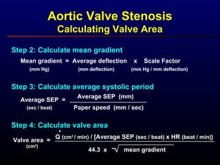 Step 2: Calculate mean gradient
Mean gradient = Average deflection x Scale Factor
(mm deflection) (mm Hg / mm deflection)(mm Hg)
Step 3: Calculate average systolic period
Average SEP =
(sec / beat)
Average SEP (mm)
Paper speed (mm / sec)
Step 4: Calculate valve area
Valve area =
(cm2
)
Q (cm3
/ min) / [Average SEP (sec / beat) x HR (beat / min)]
44.3 x mean gradient
.
Aortic Valve Stenosis
Calculating Valve Area
 