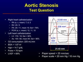 Aortic Stenosis
Test Question
• Right heart catheterization
– RA (a, v, mean): 7, 6, 5
– RV: 25 / 5
– PA: 25 / 11, mean 15; Sat = 76%
– PCW (a, v, mean): 12, 11, 10
• Left heart catheterization
– LV: 176 / 16; Sat = 96%
– Ao: 100 / 66, mean 84; Sat = 96%
• O2 consumption: 225 mL/min
• BSA = 1.87 m2
• Hgb = 14.7 g/dL
• Pulse = 70 bpm
• LVEF = 69% • Paper speed = 25 mm/sec
• Paper scale = 20 mm Hg / 10 mm Hg
8.75
mm
12.68 mm
21.43 mm
238 mm2
 