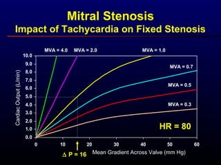 0.0
1.0
2.0
3.0
4.0
5.0
6.0
7.0
8.0
9.0
10.0
0 10 20 30 40 50 60
Mean Gradient Across Valve (mm Hg)
CardiacOutput(L/min)
HR = 80
MVA = 0.5
MVA = 0.3
MVA = 0.7
MVA = 1.0MVA = 2.0MVA = 4.0
∆ P = 16
Mitral Stenosis
Impact of Tachycardia on Fixed Stenosis
 
