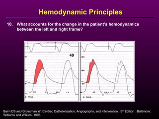 Baim DS and Grossman W. Cardiac Catheterization, Angiography, and Intervention. 5th
Edition. Baltimore:
Williams and Wilkins, 1996.
Hemodynamic Principles
10. What accounts for the change in the patient’s hemodynamics
between the left and right frame?
40
 