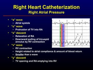 Right Heart Catheterization
Right Atrial Pressure
• “a” wave
– Atrial systole
• “c” wave
– Protrusion of TV into RA
• “a” wave
– Atrial systole
• “c” wave
– Protrusion of TV into RA
• “x” descent
– Relaxation of RA
– Downward pulling of tricuspid
annulus by RV contraction
• “v” wave
– RV contraction
– Height related to atrial compliance & amount of blood return
– Smaller than a wave
• “a” wave
– Atrial systole
• “c” wave
– Protrusion of TV into RA
• “x” descent
– Relaxation of RA
– Downward pulling of tricuspid
annulus by RV contraction
• “v” wave
– RV contraction
– Height related to atrial compliance & amount of blood return
– Smaller than a wave
• “y” descent
– TV opening and RA emptying into RV
• “a” wave
– Atrial systole
• “c” wave
– Protrusion of TV into RA
• “x” descent
– Relaxation of RA
– Downward pulling of tricuspid
annulus by RV contraction
 
