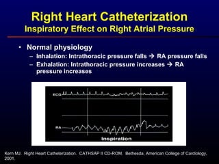 Kern MJ. Right Heart Catheterization. CATHSAP II CD-ROM. Bethesda, American College of Cardiology,
2001.
Right Heart Catheterization
Inspiratory Effect on Right Atrial Pressure
• Normal physiology
– Inhalation: Intrathoracic pressure falls  RA pressure falls
– Exhalation: Intrathoracic pressure increases  RA
pressure increases
 