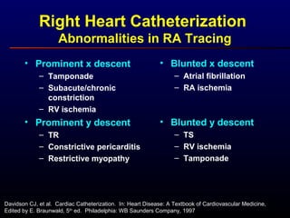 Right Heart Catheterization
Abnormalities in RA Tracing
• Prominent x descent
– Tamponade
– Subacute/chronic
constriction
– RV ischemia
• Prominent y descent
– TR
– Constrictive pericarditis
– Restrictive myopathy
• Blunted x descent
– Atrial fibrillation
– RA ischemia
• Blunted y descent
– TS
– RV ischemia
– Tamponade
Davidson CJ, et al. Cardiac Catheterization. In: Heart Disease: A Textbook of Cardiovascular Medicine,
Edited by E. Braunwald, 5th
ed. Philadelphia: WB Saunders Company, 1997
 