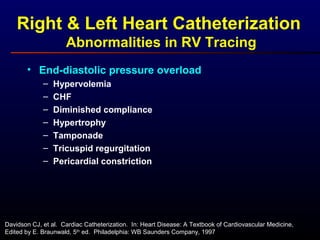 • End-diastolic pressure overload
– Hypervolemia
– CHF
– Diminished compliance
– Hypertrophy
– Tamponade
– Tricuspid regurgitation
– Pericardial constriction
Right & Left Heart Catheterization
Abnormalities in RV Tracing
Davidson CJ, et al. Cardiac Catheterization. In: Heart Disease: A Textbook of Cardiovascular Medicine,
Edited by E. Braunwald, 5th
ed. Philadelphia: WB Saunders Company, 1997
 