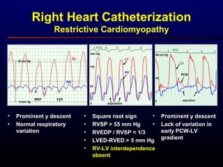 Right Heart Catheterization
Restrictive Cardiomyopathy
• Prominent y descent
• Normal respiratory
variation
• Square root sign
• RVSP > 55 mm Hg
• RVEDP / RVSP < 1/3
• LVED-RVED > 5 mm Hg
• RV-LV interdependence
absent
• Prominent y descent
• Lack of variation in
early PCW-LV
gradient
 