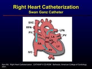 Kern MJ. Right Heart Catheterization. CATHSAP II CD-ROM. Bethesda, American College of Cardiology,
2001.
Right Heart Catheterization
Swan Ganz Catheter
 