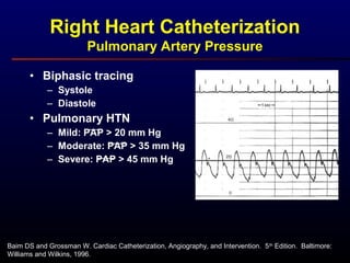 Baim DS and Grossman W. Cardiac Catheterization, Angiography, and Intervention. 5th
Edition. Baltimore:
Williams and Wilkins, 1996.
Right Heart Catheterization
Pulmonary Artery Pressure
• Biphasic tracing
– Systole
– Diastole
• Pulmonary HTN
– Mild: PAP > 20 mm Hg
– Moderate: PAP > 35 mm Hg
– Severe: PAP > 45 mm Hg
 