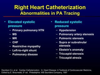 Right Heart Catheterization
Abnormalities in PA Tracing
• Elevated systolic
pressure
– Primary pulmonary HTN
– MS
– MR
– CHF
– Restrictive myopathy
– Left-to-right shunt
– Pulmonary disease
• Reduced systolic
pressure
– Hypotension
– Pulmonary artery stenosis
– Pulmonic stenosis
– Supra or subvalvular
stenosis
– Ebstein’s anomaly
– Tricuspid stenosis
– Tricuspid atresia
Davidson CJ, et al. Cardiac Catheterization. In: Heart Disease: A Textbook of Cardiovascular Medicine,
Edited by E. Braunwald, 5th
ed. Philadelphia: WB Saunders Company, 1997
 