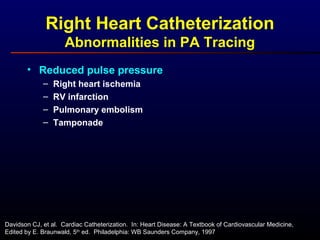 • Reduced pulse pressure
– Right heart ischemia
– RV infarction
– Pulmonary embolism
– Tamponade
Right Heart Catheterization
Abnormalities in PA Tracing
Davidson CJ, et al. Cardiac Catheterization. In: Heart Disease: A Textbook of Cardiovascular Medicine,
Edited by E. Braunwald, 5th
ed. Philadelphia: WB Saunders Company, 1997
 