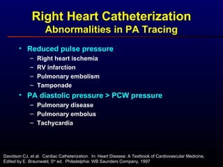 • Reduced pulse pressure
– Right heart ischemia
– RV infarction
– Pulmonary embolism
– Tamponade
• PA diastolic pressure > PCW pressure
– Pulmonary disease
– Pulmonary embolus
– Tachycardia
Right Heart Catheterization
Abnormalities in PA Tracing
Davidson CJ, et al. Cardiac Catheterization. In: Heart Disease: A Textbook of Cardiovascular Medicine,
Edited by E. Braunwald, 5th
ed. Philadelphia: WB Saunders Company, 1997
 