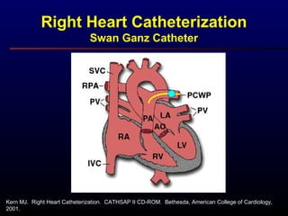 Kern MJ. Right Heart Catheterization. CATHSAP II CD-ROM. Bethesda, American College of Cardiology,
2001.
Right Heart Catheterization
Swan Ganz Catheter
PCWP
 