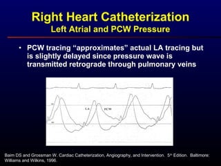 Baim DS and Grossman W. Cardiac Catheterization, Angiography, and Intervention. 5th
Edition. Baltimore:
Williams and Wilkins, 1996.
Right Heart Catheterization
Left Atrial and PCW Pressure
• PCW tracing “approximates” actual LA tracing but
is slightly delayed since pressure wave is
transmitted retrograde through pulmonary veins
 