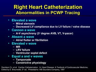 • Elevated a wave
– Mitral stenosis
– Decreased LV compliance due to LV failure / valve disease
• Cannon a wave
– A-V asynchrony (3rd
degree AVB, VT, V-pacer)
• Absent a wave
– Atrial flutter or fibrillation
• Elevated v wave
– MR
– LRV failure
– Ventricular septal defect
• Equal a and v waves
– Tamponade
– Constrictive physiology
Right Heart Catheterization
Abnormalities in PCWP Tracing
Davidson CJ, et al. Cardiac Catheterization. In: Heart Disease: A Textbook of Cardiovascular Medicine,
Edited by E. Braunwald, 5th
ed. Philadelphia: WB Saunders Company, 1997
 