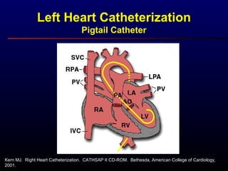 Kern MJ. Right Heart Catheterization. CATHSAP II CD-ROM. Bethesda, American College of Cardiology,
2001.
Left Heart Catheterization
Pigtail Catheter
 