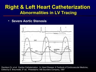 Right & Left Heart Catheterization
Abnormalities in LV Tracing
• Severe Aortic Stenosis
Davidson CJ, et al. Cardiac Catheterization. In: Heart Disease: A Textbook of Cardiovascular Medicine,
Edited by E. Braunwald, 5th
ed. Philadelphia: WB Saunders Company, 1997
 