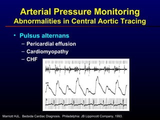 Arterial Pressure Monitoring
Abnormalities in Central Aortic Tracing
• Pulsus alternans
– Pericardial effusion
– Cardiomyopathy
– CHF
Marriott HJL. Bedside Cardiac Diagnosis. Philadelphia: JB Lippincott Company, 1993.
 