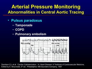 Arterial Pressure Monitoring
Abnormalities in Central Aortic Tracing
• Pulsus paradoxus
– Tamponade
– COPD
– Pulmonary embolism
Davidson CJ, et al. Cardiac Catheterization. In: Heart Disease: A Textbook of Cardiovascular Medicine,
Edited by E. Braunwald, 5th
ed. Philadelphia: WB Saunders Company, 1997
 