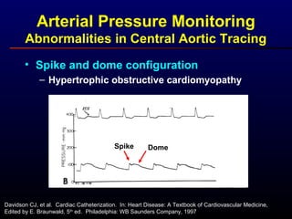 Arterial Pressure Monitoring
Abnormalities in Central Aortic Tracing
• Spike and dome configuration
– Hypertrophic obstructive cardiomyopathy
Davidson CJ, et al. Cardiac Catheterization. In: Heart Disease: A Textbook of Cardiovascular Medicine,
Edited by E. Braunwald, 5th
ed. Philadelphia: WB Saunders Company, 1997
Spike Dome
 