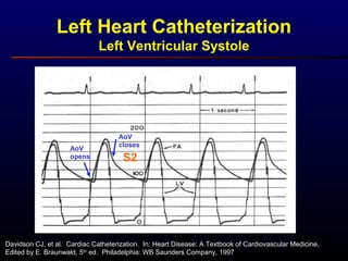 Davidson CJ, et al. Cardiac Catheterization. In: Heart Disease: A Textbook of Cardiovascular Medicine,
Edited by E. Braunwald, 5th
ed. Philadelphia: WB Saunders Company, 1997
Left Heart Catheterization
Left Ventricular Systole
AoV
opens
AoV
closes
S2
 