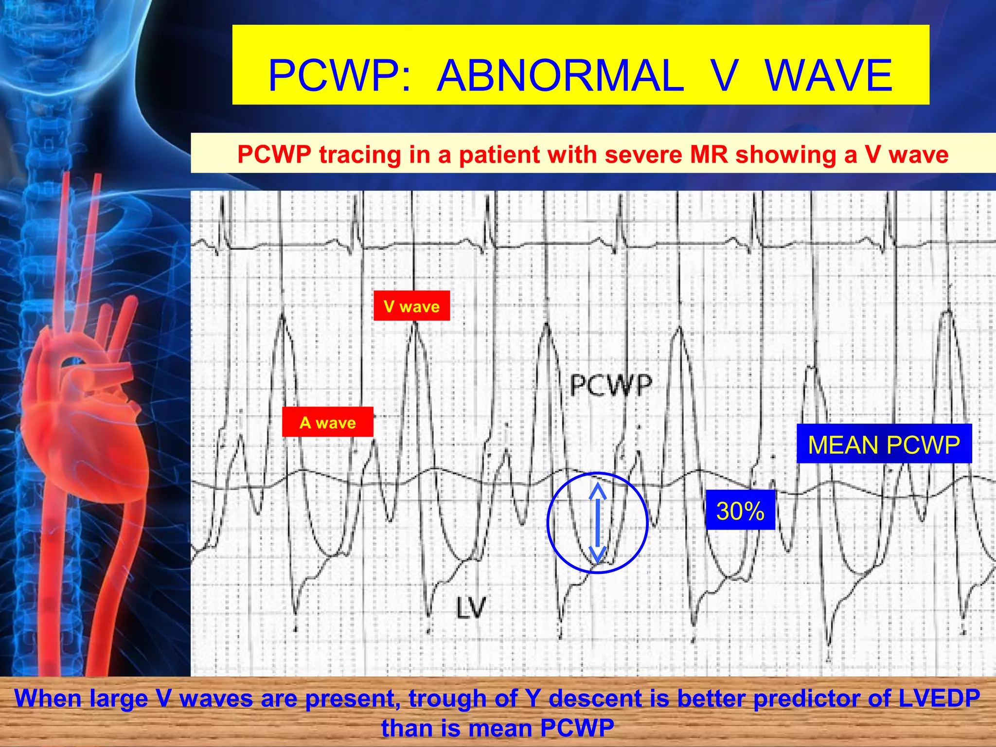 Hemodynamic | PPT
