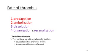 49
Fate of thrombus
1.propagation
2.embolization
3.dissolution
4.organization& recanalization
Clinical correlations
• Thrombi are significant clinically in that:
• cause obstruction of arteries & veins
• they are possible source of emboli
 