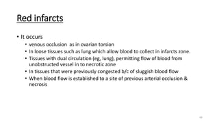 68
Red infarcts
• It occurs
• venous occlusion as in ovarian torsion
• In loose tissues such as lung which allow blood to collect in infarcts zone.
• Tissues with dual circulation (eg, lung), permitting flow of blood from
unobstructed vessel in to necrotic zone
• In tissues that were previously congested b/c of sluggish blood flow
• When blood flow is established to a site of previous arterial occlusion &
necrosis
 