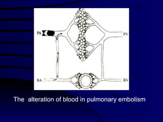 The  alteration of blood in pulmonary embolism 