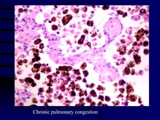 Chronic pulmonary congestion 