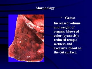 Gross: Increased volume and weight of organs; blue-red color (cyanosis); reduced temp.; wetness and excessive blood on the cut surface. Morphology 