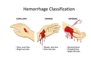 Pathology Bio 134 Hemodynamic disorders