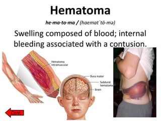 Pathology Bio 134 Hemodynamic disorders