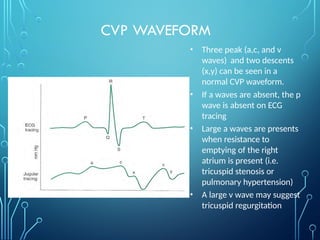 Hemodynamic-Monitoring in anaesthesia (TRILOK).pptx