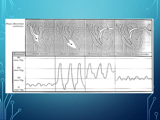 Hemodynamic-Monitoring in anaesthesia (TRILOK).pptx