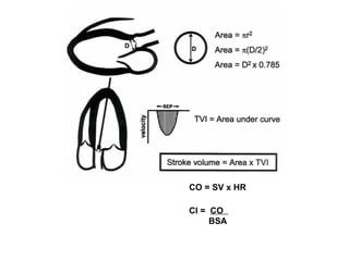 CO = SV x HR
CI = CO
BSA
 