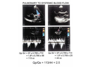 PULMONARY TO SYSTEMIC BLOOD FLOW
 