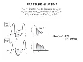 PRESSURE HALF TIME
MVA(cm2
)= 220
PHT (msec)
 