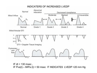INDICATERS OF INCREASED LVEDP
IF dt < 130 msec ,
IF Pva(t) – MIPa (t) > 50 msec IT INDICATES LVEDP >20 mm Hg
 