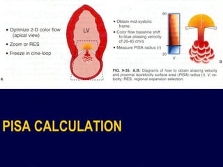 Hemodynamic assessment in cardiology | PPT