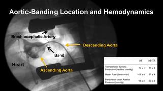 Brachiocephalic Artery
Band
Descending Aorta
Ascending Aorta
Heart
Aortic-Banding Location and Hemodynamics
 