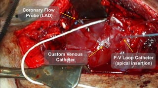 Coronary Flow
Probe (LAD)
P-V Loop Catheter
(apical insertion)
Custom Venous
Catheter
 