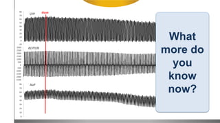 What
more do
you
know
now?
 