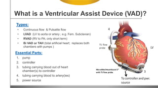 Essential Parts:
1. pump
2. controller
3. tubing carrying blood out of heart
chamber(s) to controller
4. tubing carrying blood to artery(ies)
5. power source
What is a Ventricular Assist Device (VAD)?
Types:
• Continuous flow & Pulsatile flow
• LVAD (LV to aorta or artery ; e.g. Fem. Subclavian)
• RVAD (RV to PA; only short term)
• Bi VAD or TAH (total artificial heart; replaces both
chambers with pumps )
 