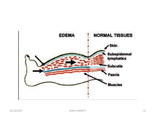 10/13/2018 SUNIL KUMAR P 12
 