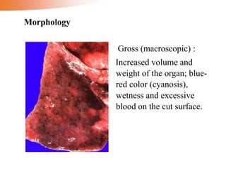 Gross (macroscopic) :
Increased volume and
weight of the organ; blue-
red color (cyanosis),
wetness and excessive
blood on the cut surface.
Morphology
 